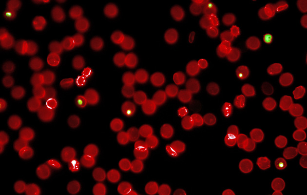 Das Bild zeigt rote Blutkörperchen unter dem Mikroskop