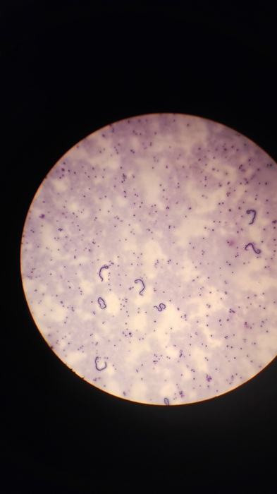 Das Bild zeigt eine mikroskopische Aufnahme eines mit Augenwürmern infizierten Gewebe. Das Bild zeigt eine mikroskopische Aufnahme eines mit Augenwürmern infizierten Gewebe.
