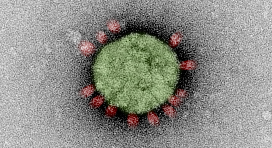 [Translate to English:] Coronavirus Bild mit Link zur SARS-CoV-2 Forschung und Kooperationen des BNITM