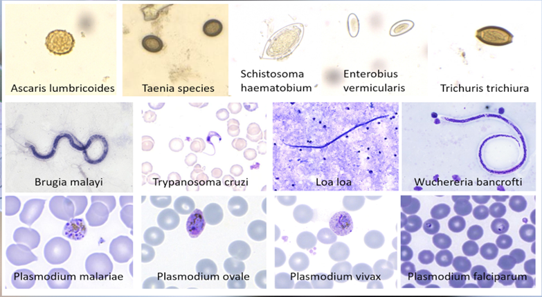 [Translate to English:] Mikroskopische Aufnahmen von Parasiten mit Link zur Wesbseite ParasiteWeb(TM) von Fraunhofer und BNITM