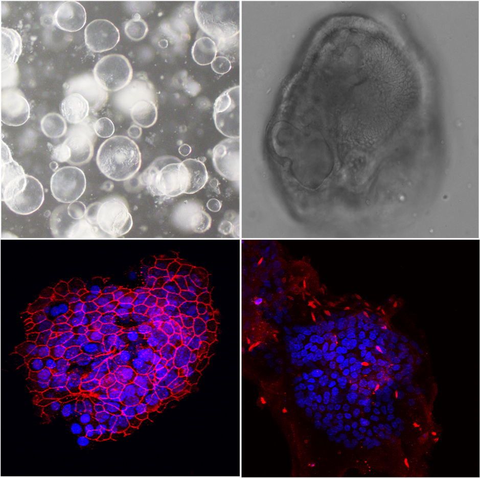 Auf dem Bild sind lichtmikroskopische sowie Fluoreszenz-Aufnahmen einer Organoidkultur zu sehen.