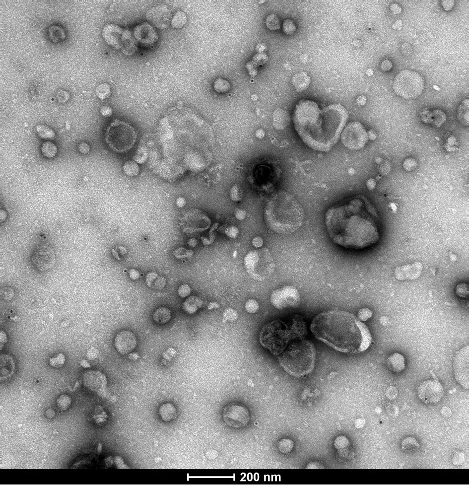 EVs-Entamoeba-parasites Black-and-white-transmission electron microscopy of extracellular vesicles