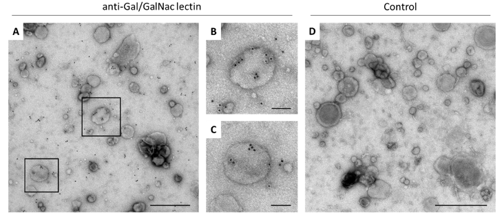Detection of Gal/GalNac lectin on E. histolytica EVs by immunogold labeling Black-and-white-photo of cells and EVs-Entamoeba-parasites showing the extracellular vesicles