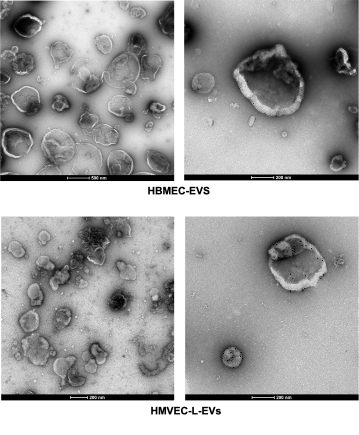 Extracellular vesicles purified from human brain endothelial cells (HBMEC-EVS) and human lung endothelial cells (HMVEC-L-EVs)