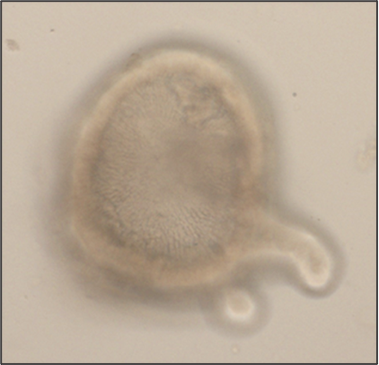 Image of an organoid from the large intestine