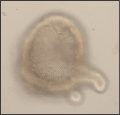 Image of an organoid from the large intestine Image of an organoid from the large intestine