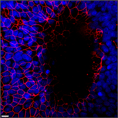 Immunofluorescent image of a large intestinal organoid-derived monolayer infected  with E. histolytica trophozoites