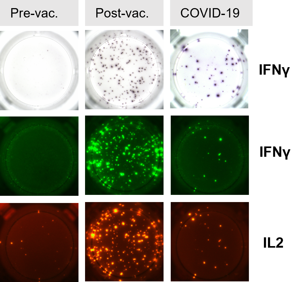 T Zellen Elispot: zu sehen sind mehre kleine Bilder, die eine Probe pre, post und Covid-19 darstellt. in der oberen Reihe sieht man bei IFNg ein durchsichtiges Well mit unterschiedlichen vielen und großen lila Punkten (die meisten bei COVID-19), darunter ein Bild (IFNg) mit schwarzem Hintergrund und grünen Punkten, die meisten Punkte bei Post-vac. In der letzten Reihe IL-2, ebenfalls mit schwarzem Hintergrund und roten Punkten. Die meisten Punkte sind bei Post-vac zu sehen.
