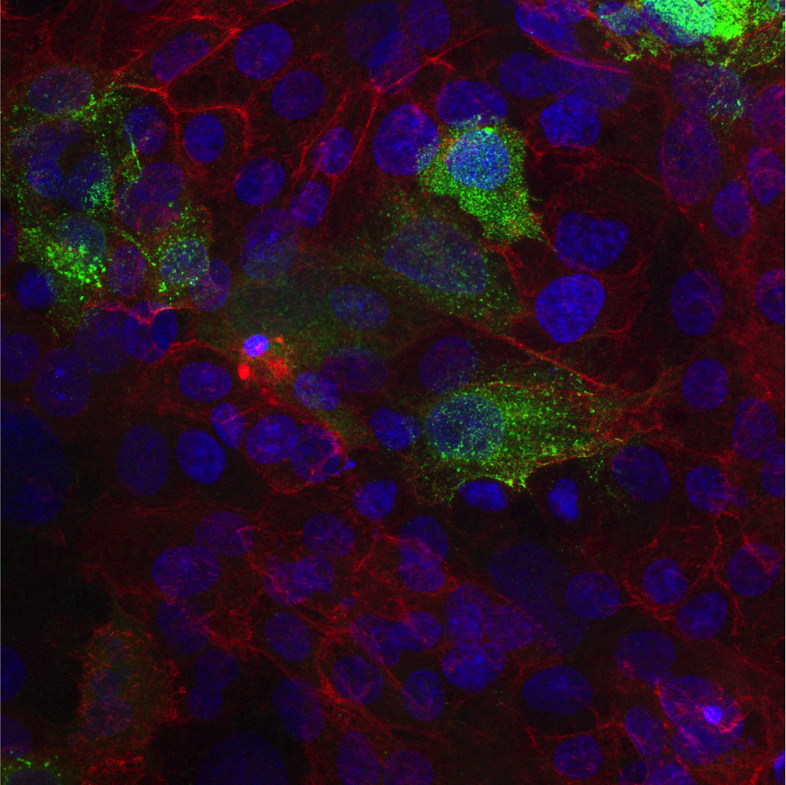 SARS-CoV-2 infizierte Verozellen SARS-CoV-2 infizierte Verozellen mit angefärbtem, gebundendenem SARS-CoV-2 monoklonalem Antikörper 5D4