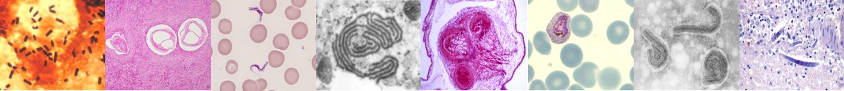 Mikroskopische Ansicht von Infektionserregern der Labordiagnostik am BNITM: Bakterien, Parasiten, Viren, Würmer, etc.