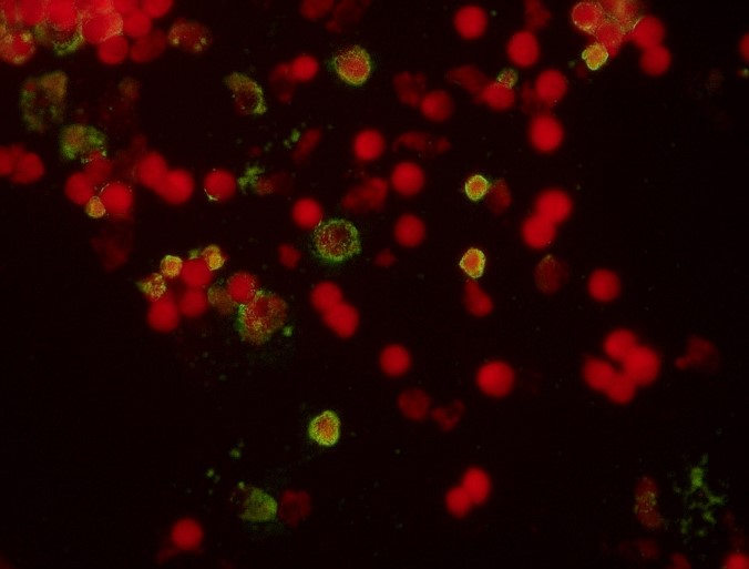 Rickettsia diagnostics - Indirect immunofluorescence of the blood. Several red circles on a black background can be seen. Some of the red spheres have a green glowing veil around the outer area.